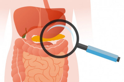 The Exocrine Pancreatic Insufficiency (EPI) Therapeutics Includes Enzyme Replacement And Dietary Changes