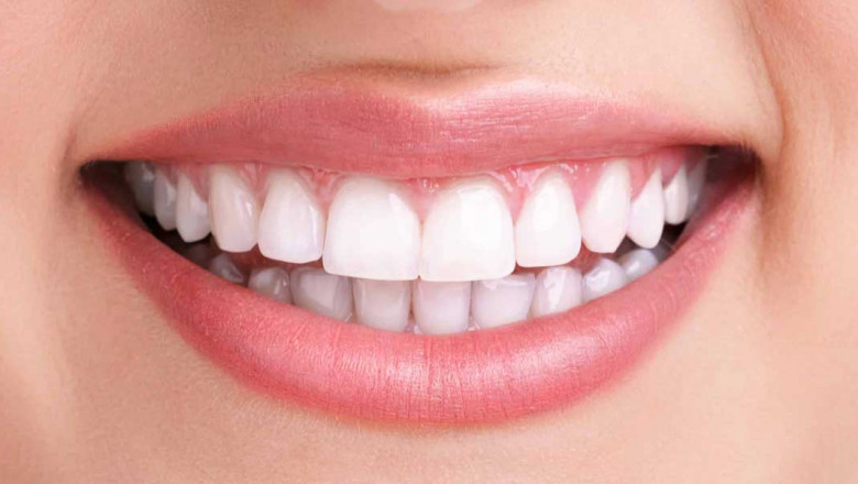 What Are The Crucial Facts About Dental Implant Surgery?