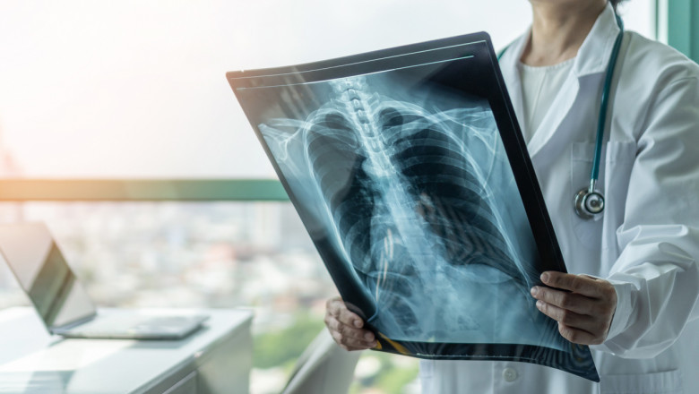 An X-Ray, Also Known As Radiography, Produces Images Of The Internal Structures Of The Body By Using Ionizing Radiation