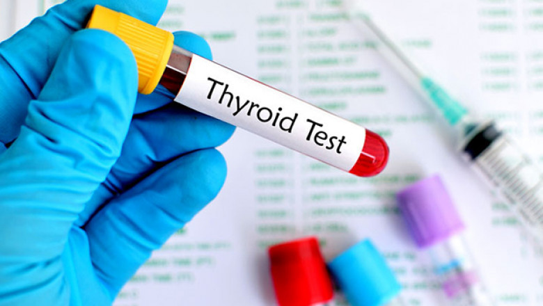 The Various Types Of Thyroid Tests And Which One Is Best For You