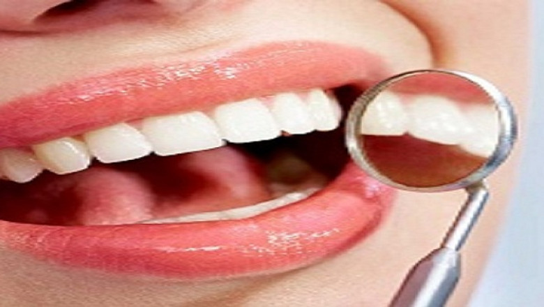 What Do You Know About Dental Bone Grafting?