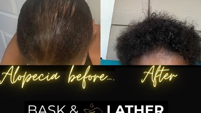 5 Tips to Help Kickstart Your Hair Growth Journey Back