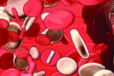 Global Beta-thalassemia (B-thal) Market Restraints