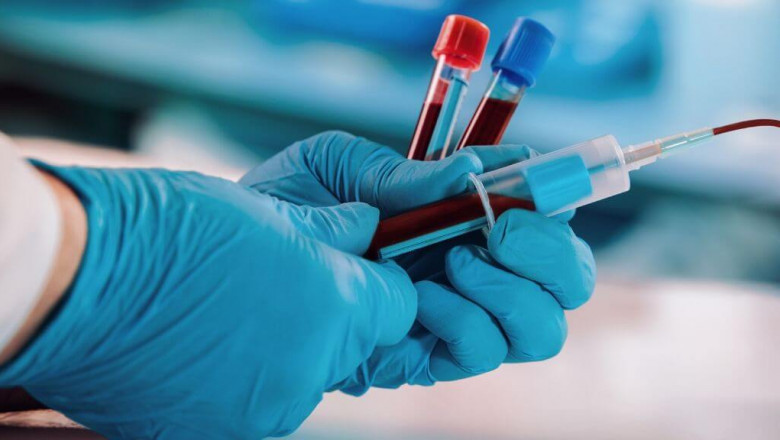 Phlebotomy Tubes in Light Blue are Commonly Used for Collecting Blood