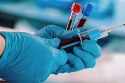 Phlebotomy Tubes in Light Blue are Commonly Used for Collecting Blood