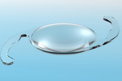 Intraocular Lens Implants Are Artificial Replacements For The Lenses Of The Eyes, Used To Correct Cataracts