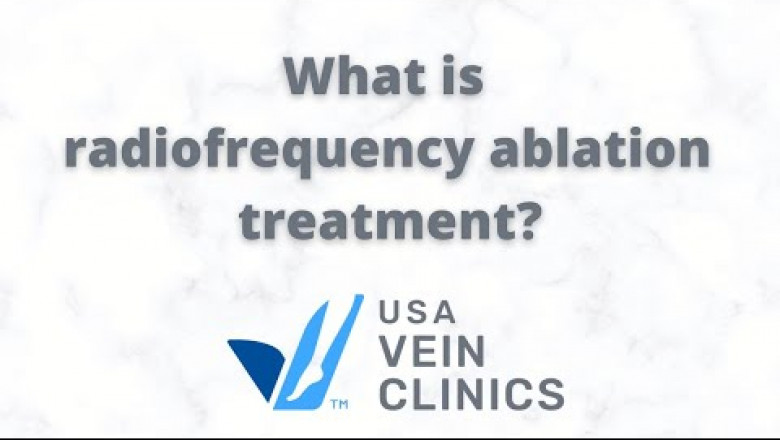 What is radiofrequency ablation treatment? | USA VEIN CLINICS