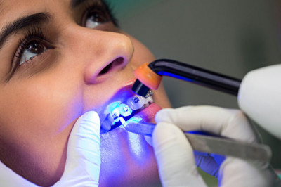 MYTHS AND FACTS ABOUT TEETH BRACES | ORTHODONTIST IN GURGAON