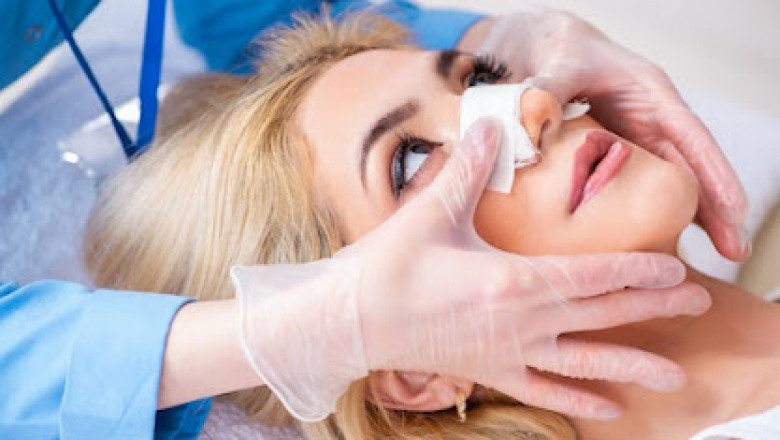 Why do Nasal fractures happen?
