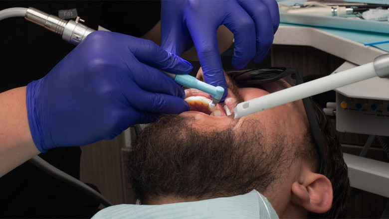 How Do Porcelain Veneers Improve Your Smile?