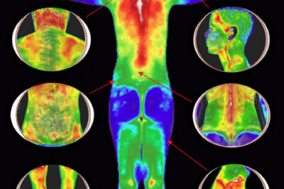 There Are Several Advantages To Using Near Infrared Medical Imaging Over Other Radio-Imaging Techniques Currently Available