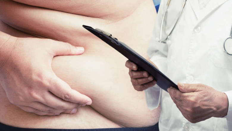 How Can Gastric Sleeve Surgery Help You Shed Pounds?