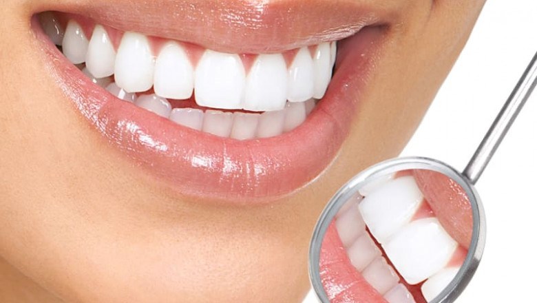 How Does Dental Bonding Help?