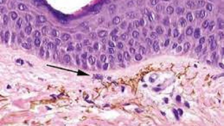 Pseudo Collagen Market Size, Key Players Analysis And Forecast To 2028 | Value Market Research