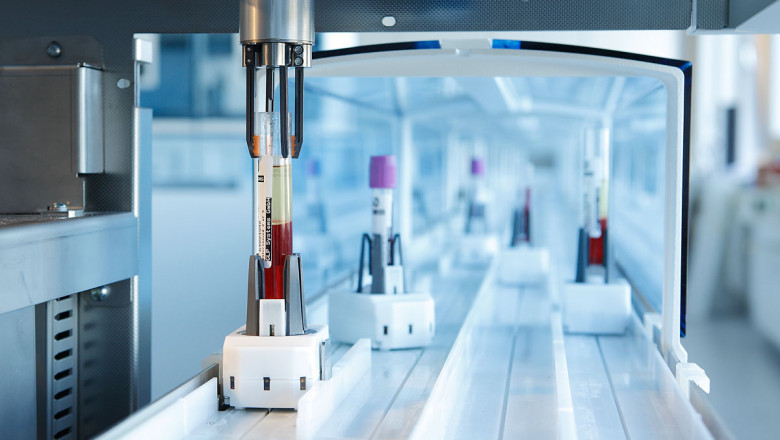 A study of the global Automated Liquid Handling Systems Market : trends, market size, growth, opportunity, as well as forecasts for 2022-2028