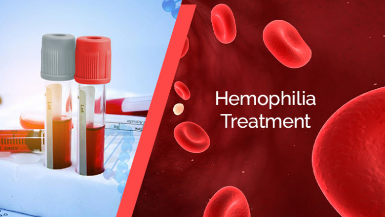 A study of the global Hemophilia Treatment Market: trends, market size, growth, opportunity, as well as forecasts for 2019-2027
