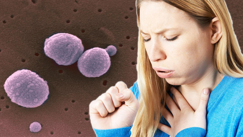 A study of the global Pharyngitis Therapeutics Market: trends, market size, growth, opportunity, as well as forecasts for 2022-2028