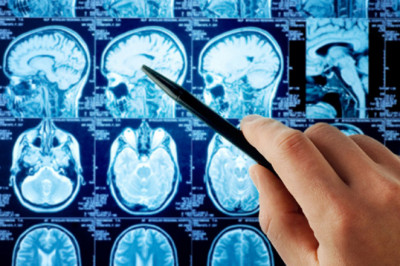 Adult Malignant Glioma Therapeutics Market Size, Share, Trends & Forecast 2029