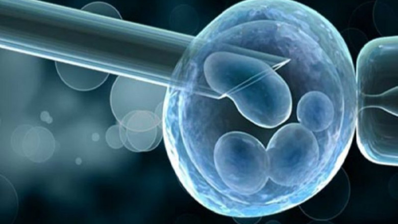 Global Preimplantation Genetic Diagnosis Market Analysis