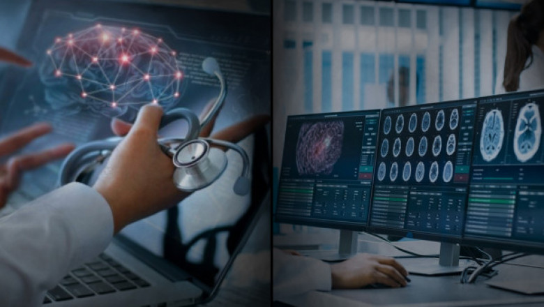 Teleradiology Market Report 2028 | Industry Analysis By Top Key Players