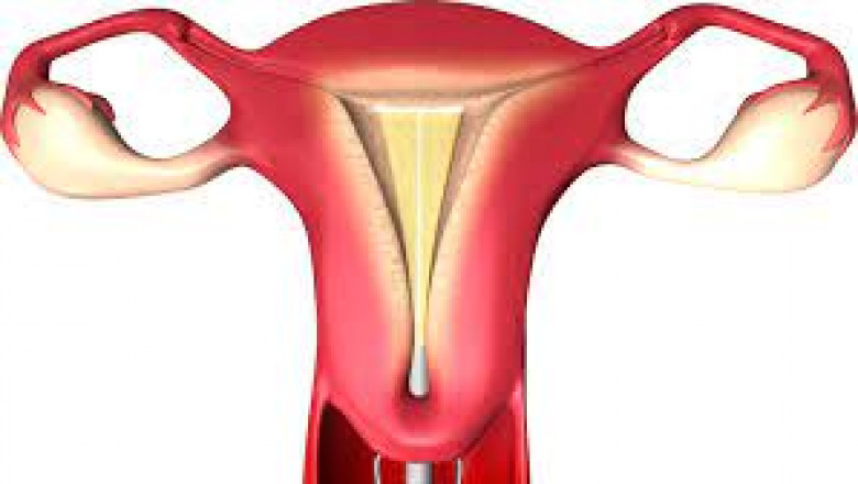 Endometrial Ablation Market Proliferating Opportunities, New Innovation, Development, Application Till 2028
