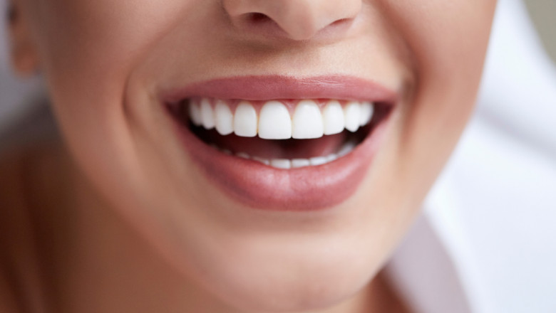 Hollywood Smile: a guide with everything you need to know about it.