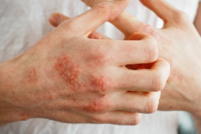 Why You Should Use Homeopathy Doctor For Skin
