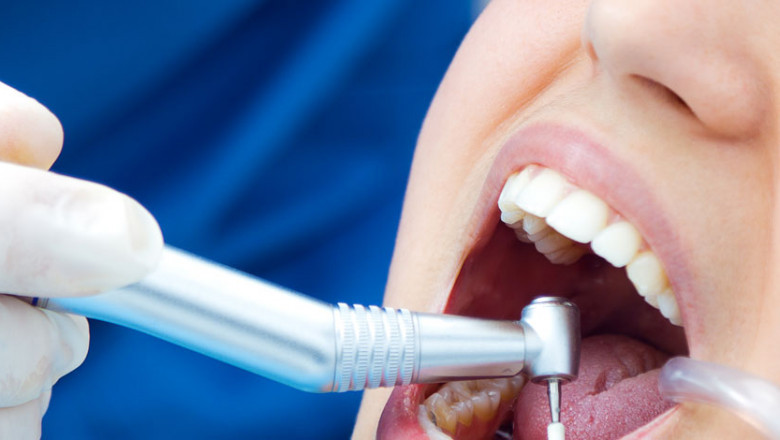 Why Should You Visit Dental Clinic?