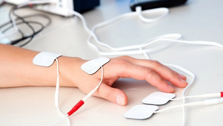 An Electrical Stimulation Devices triggers specific muscles and nerves by sending small electrical impulses