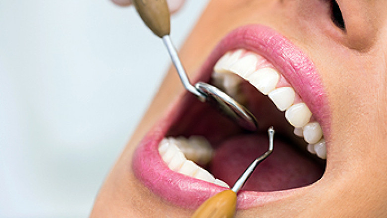 Locating a Different Dental Expert