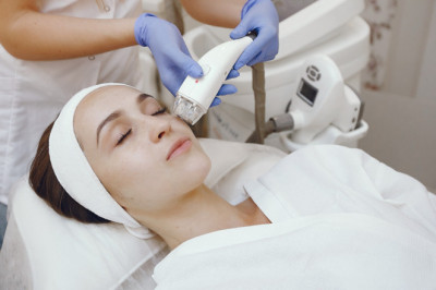 microneedling with radiofrequency