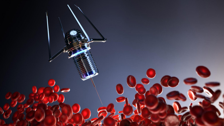 Urology Robotic Surgery Market Opportunity Analysis for 2029