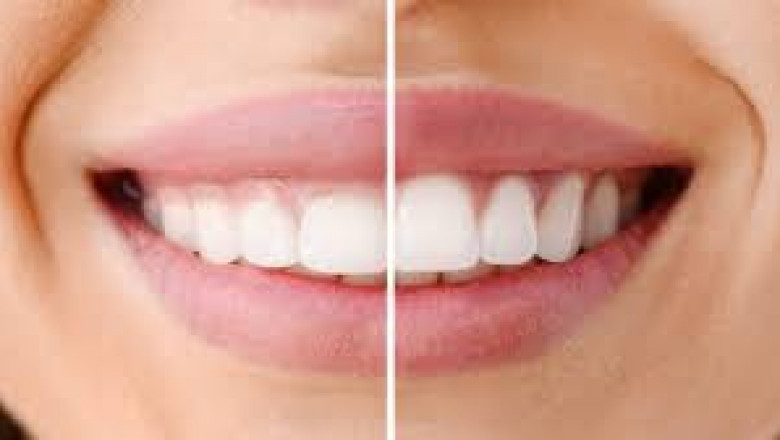 How Do Dentists Diagnose Gum Diseases?