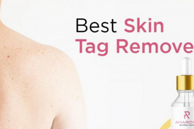 Don’t Think Too Much While Choosing Amarose Skin Tag Remover