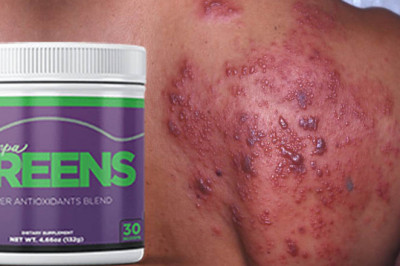 HerpaGreens Supplement Really Work For Herpes Virus?