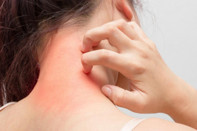 Pruritus Therapeutics Market Size, Share, Growth, Opportunities and Global Forecast to 2028