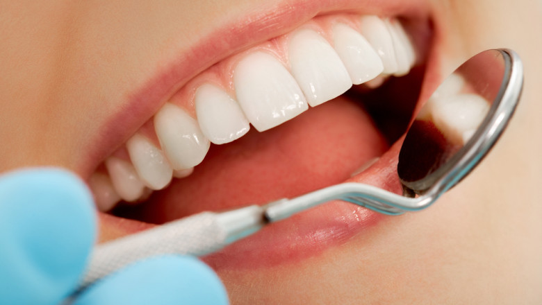 Dental Caries Market Size, Share, Growth, Sales Revenue and Key Drivers Analysis Research Report by 2028