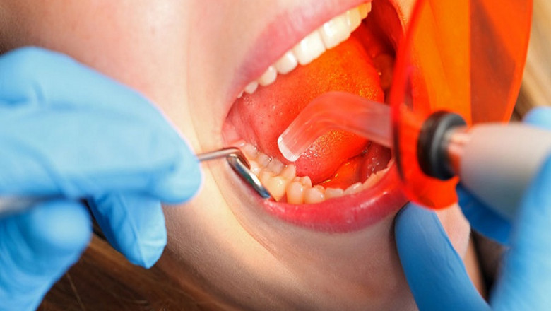 What is an Emergency Dentist?