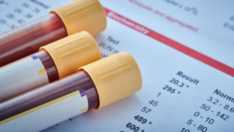 Food Sensitivity Test - MRT Food Sensitivity Test