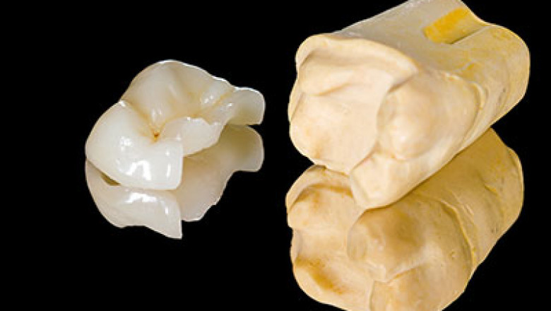 How Do You Select Affordable Dentures?