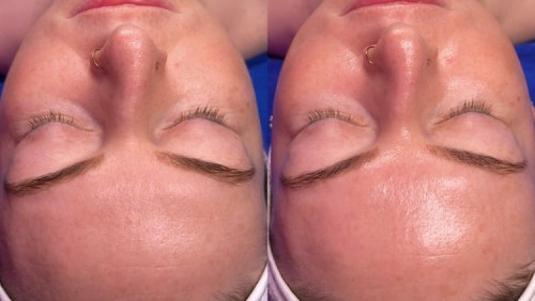The Complete Guide to Facial Care Products and How They are Disrupting the Beauty Industry