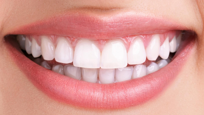 What Are The Causes Of Cracked Teeth?