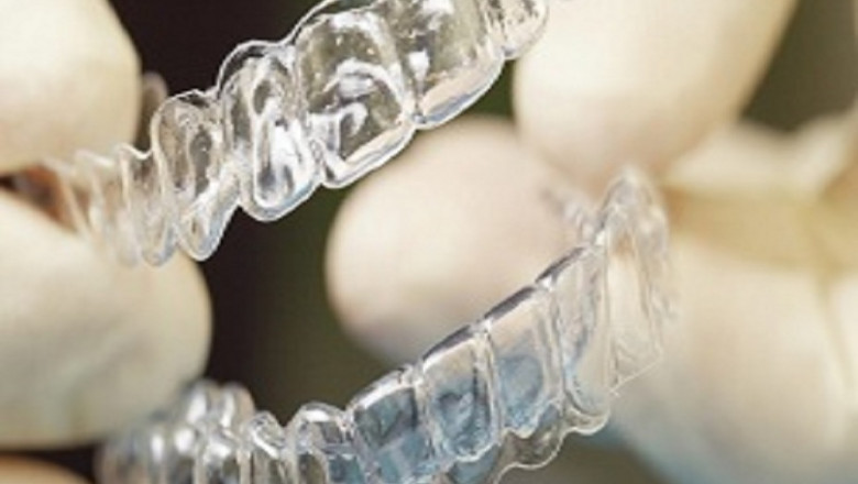 What Do You Need to Know About Ppo Dental Insurance?