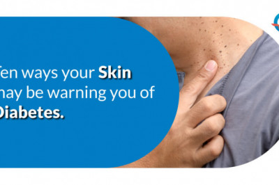 10 Ways Your Skin May Be Warning You of Diabetes