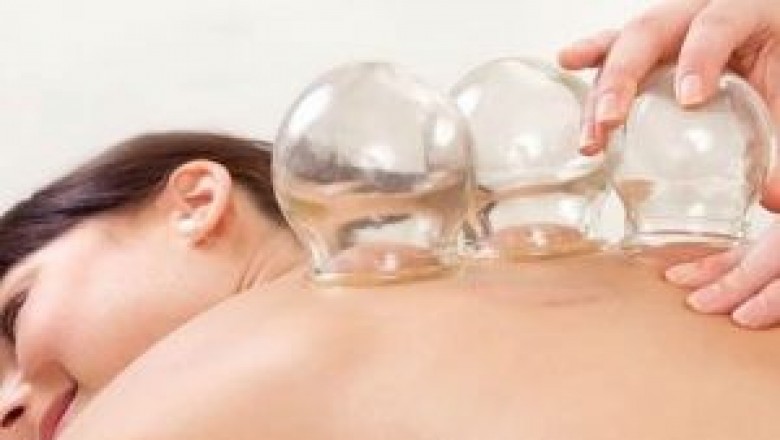 Cupping therapy benefits | Acupuncture cupping Ottawa