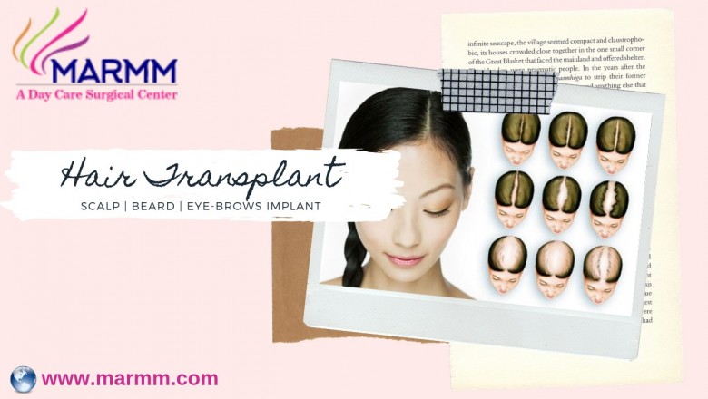 Hair Transplant in Indore to treat dead scalp and get original looks