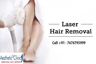 Laser Hair Removal and Laser Tattoo Removal – Aestheticplusclinic.In