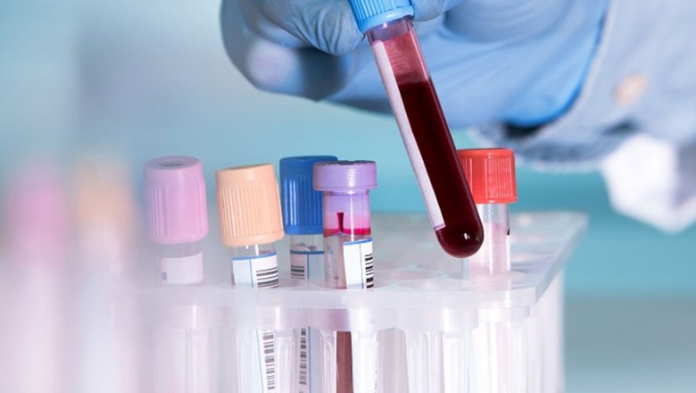 Blood test service in Delhi