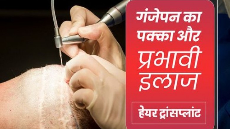 Hair Doctor in Indore Useful Medication For Healthy Hair Growth