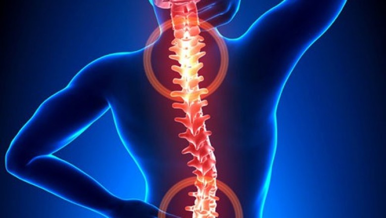 Ayurveda treatment for Neck Pain